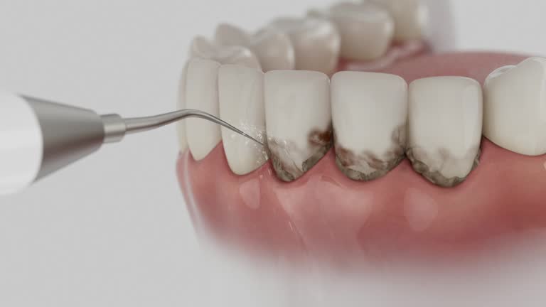 Reliable Teeth Cleaning And Checkup contractor in Taliaferro County County, GA by Dentist Open Now